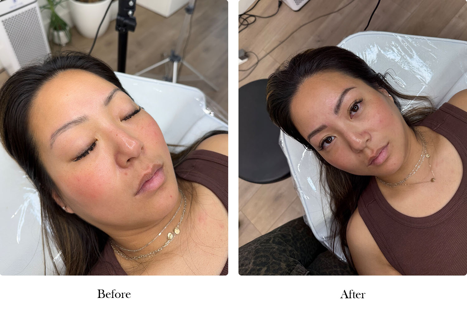 gallery-before-after-final-image2
