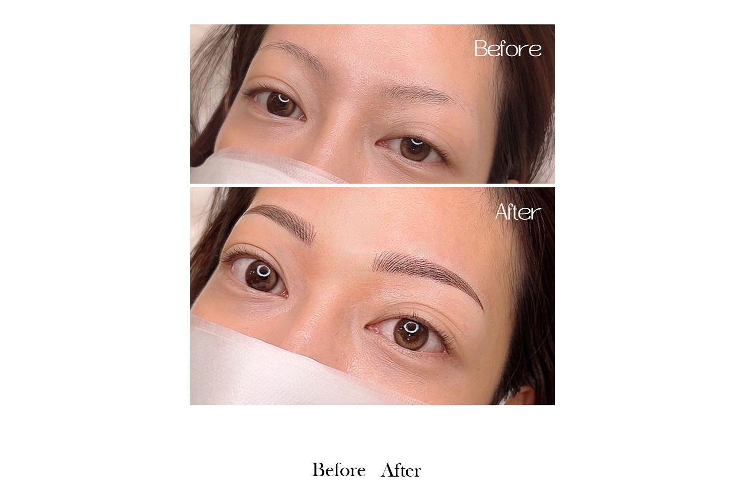 gallery-before-after-image3