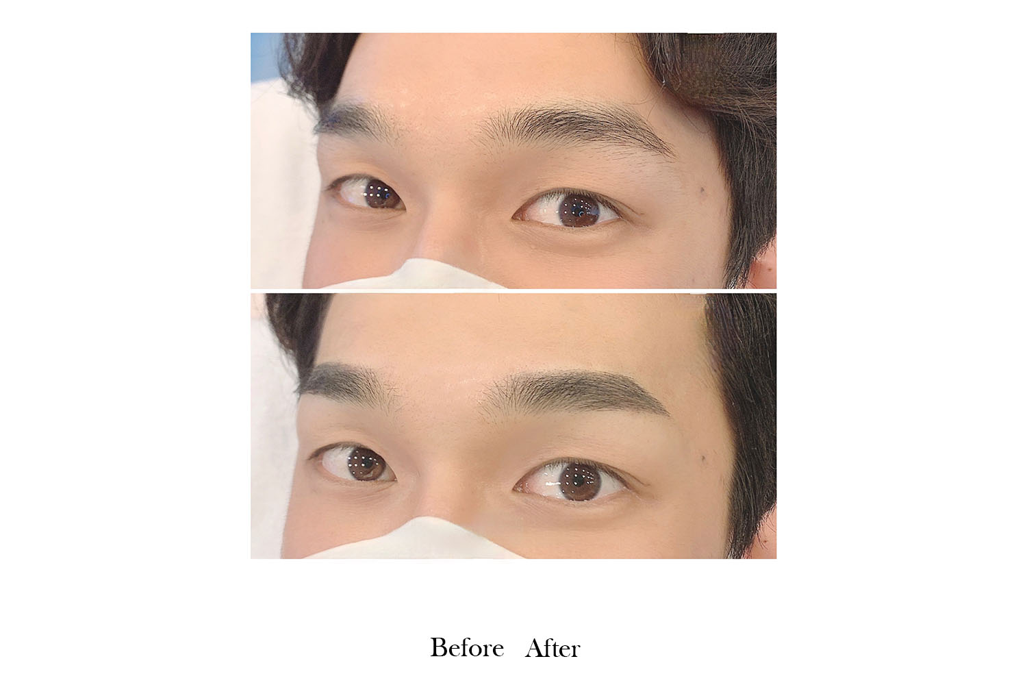 gallery-before-after-image6