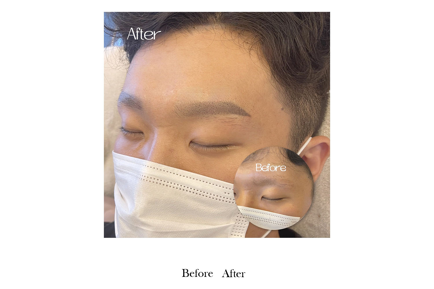 gallery-before-after-image7