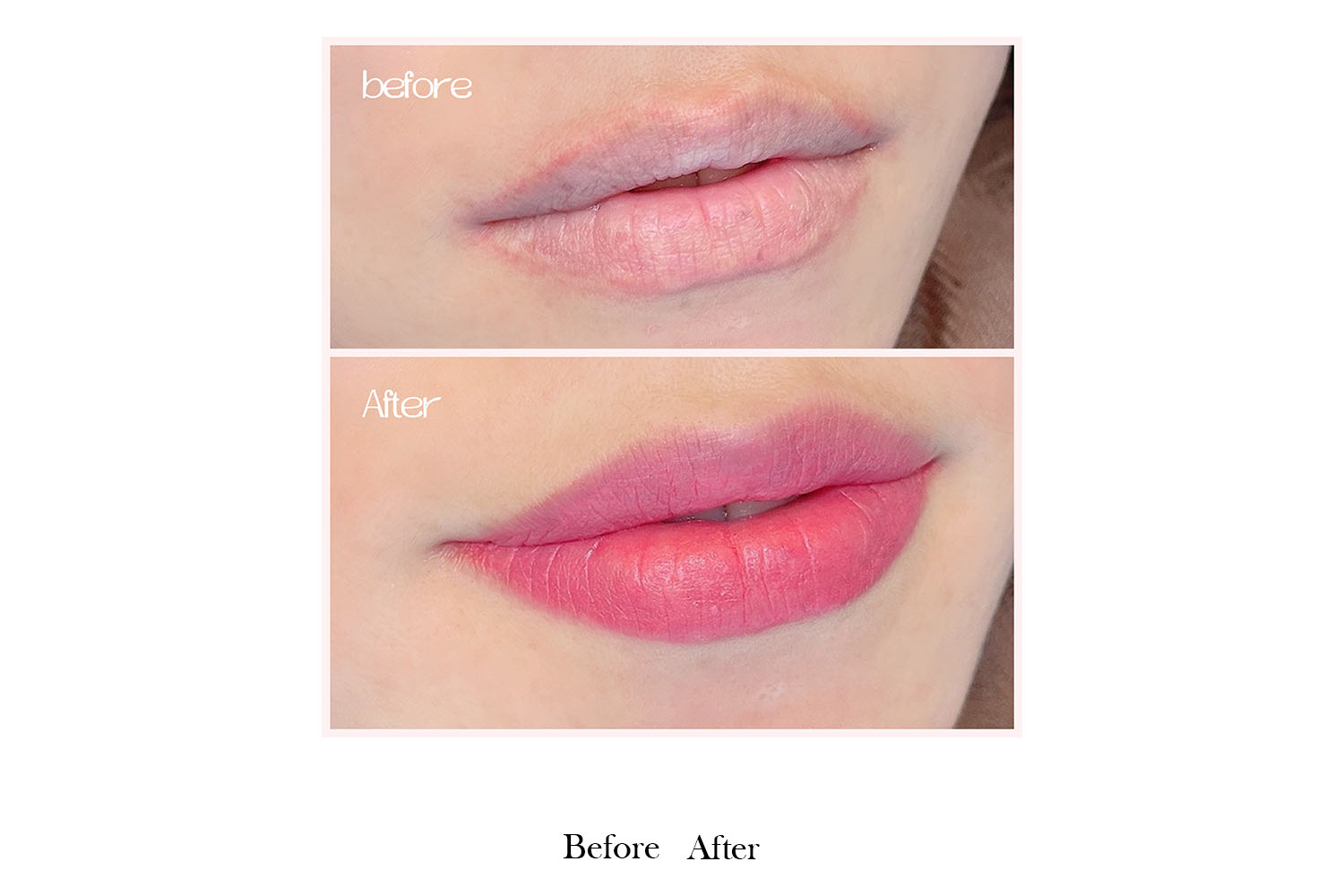 gallery-before-after-image8